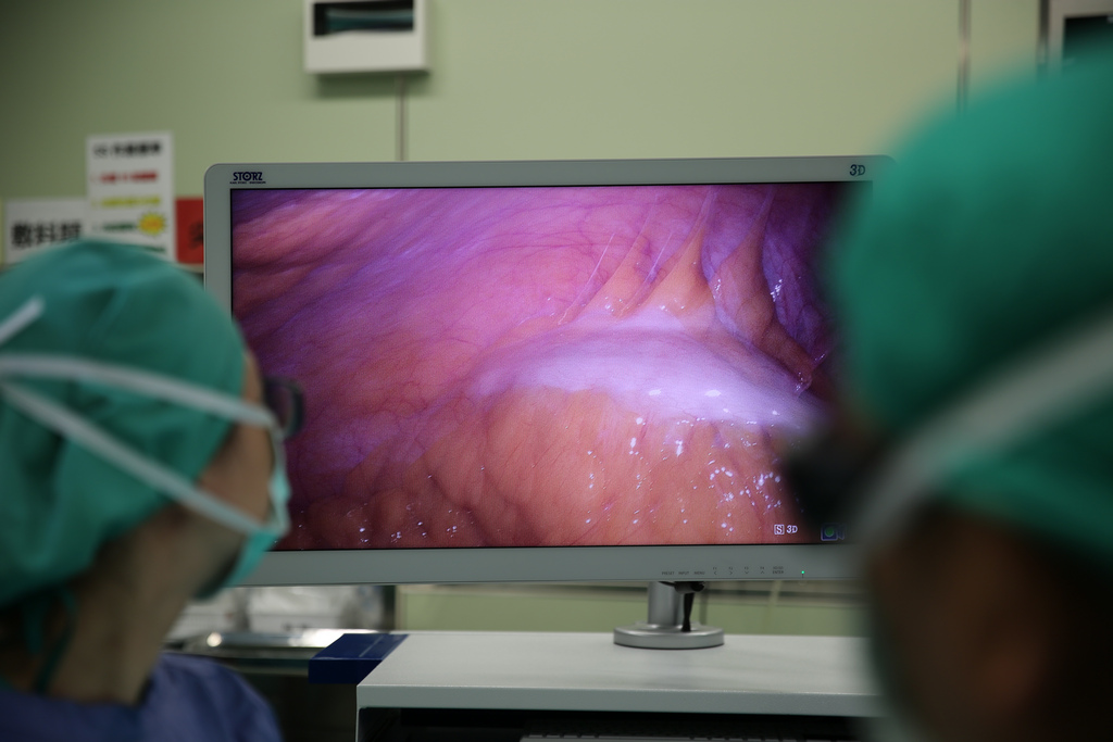 3D內視鏡系統可以將傳統2D視野轉圜成3D影像