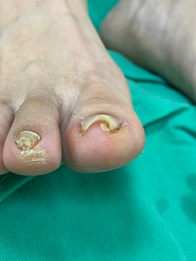 花蓮慈院皮膚科團隊為東部地區民眾，引進新式的矯正方式