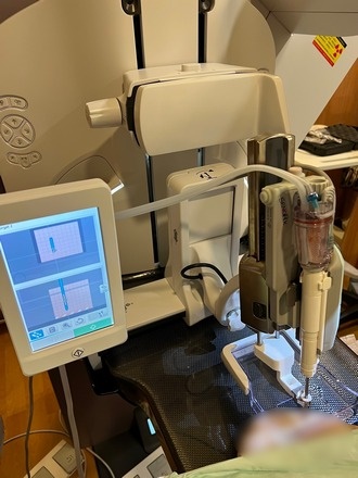 乳房攝影立體定位真空輔助切片