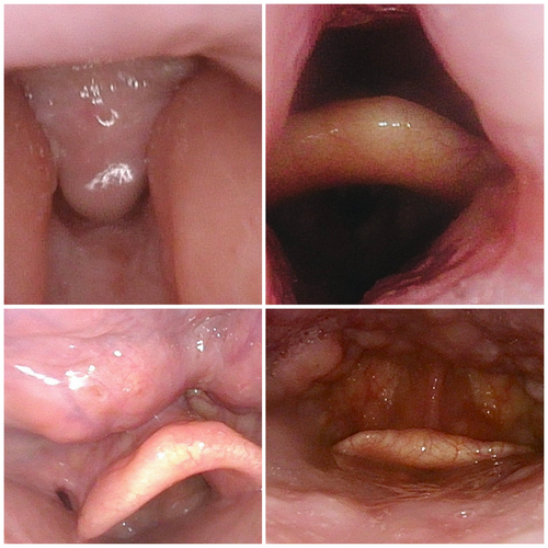 SS1556DC81 CBFF 4053 8B97 3CE06C6C8BE4