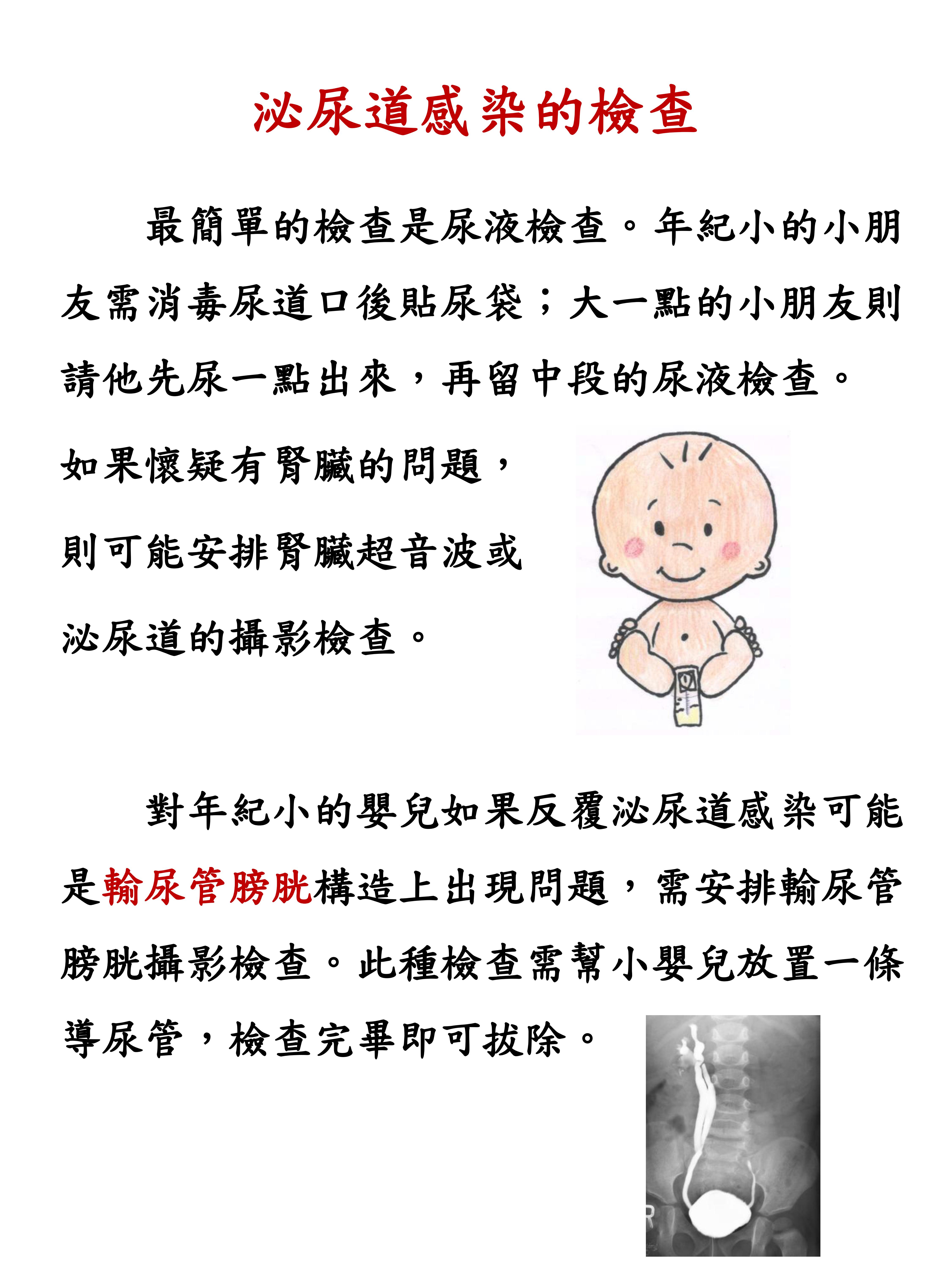 02 小兒不明原因發燒4