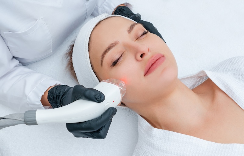 Young woman receiving laser treatment