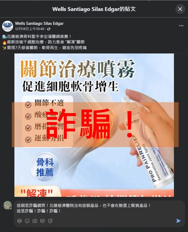 網路不明業者以詐騙粉專帳號，假造醫師代言不明產品「關節治療噴霧」。