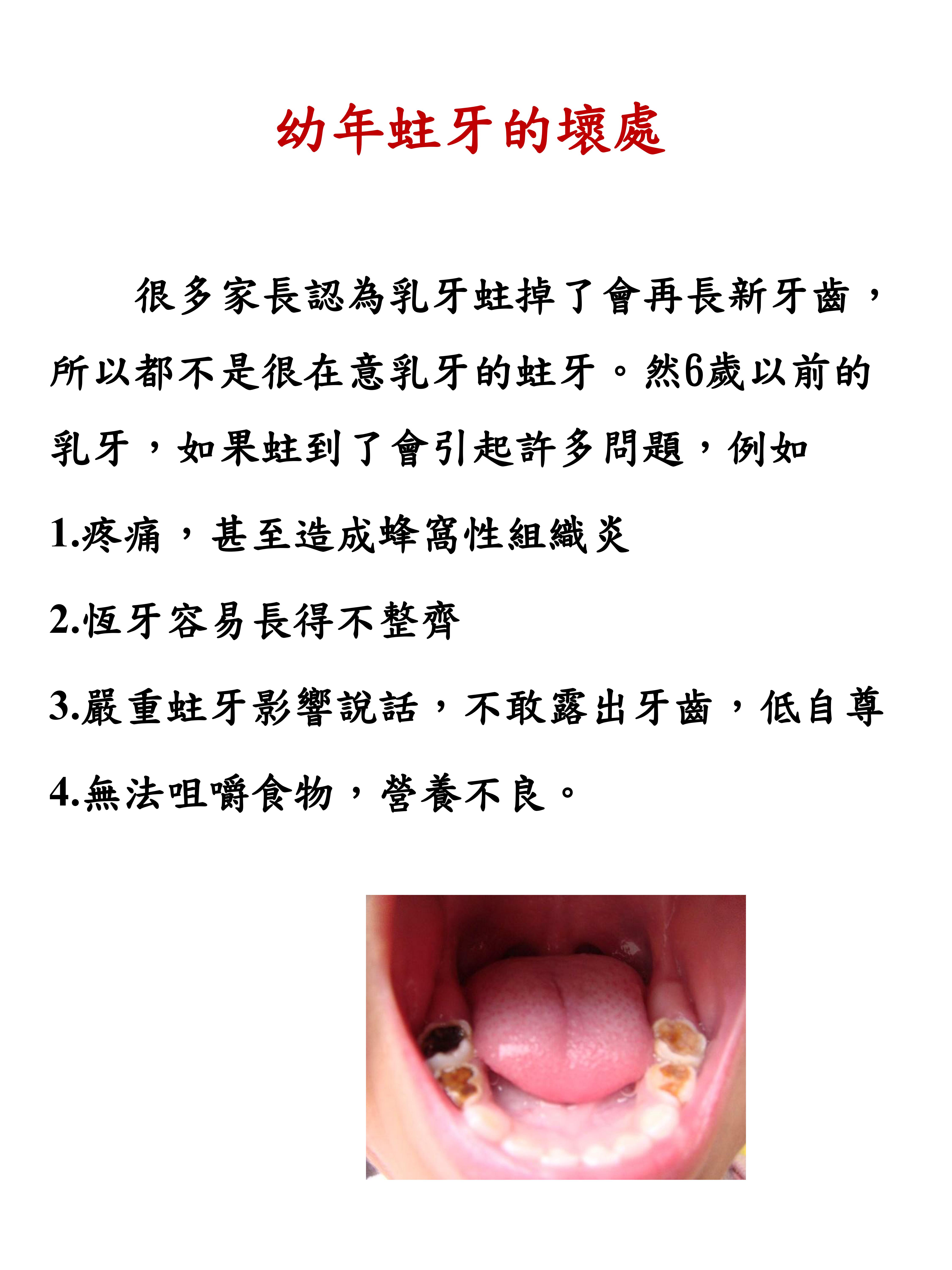 07 預防小兒蛀牙怎麼做2