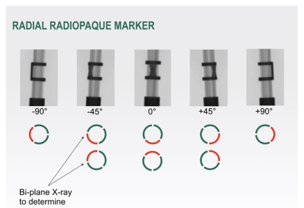 二代DBS晶片示意圖