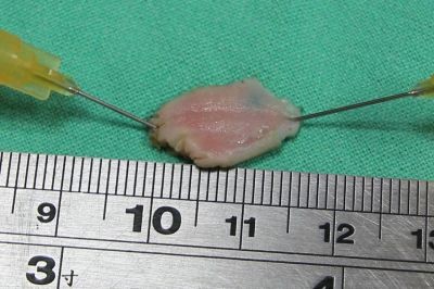 利用假日精進,腸胃內科團隊學習內視鏡黏膜下剝離術