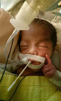 百里牽掛 因愛無距（早產兒宥宥的故事）