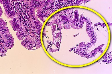 觀察入微守護生命 他們是「醫檢師」!