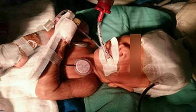 百里牽掛 因愛無距（早產兒宥宥的故事）