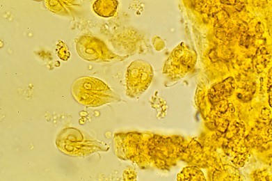 觀察入微守護生命 他們是「醫檢師」!