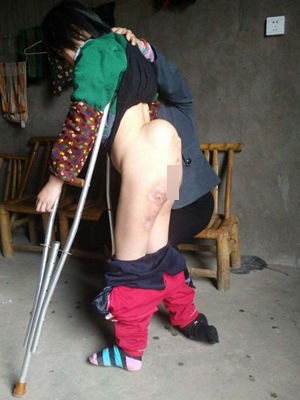 陽雨，花蓮慈院陪妳，為人生的跨步而努力