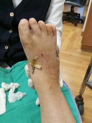 陽雨，花蓮慈院陪妳，為人生的跨步而努力