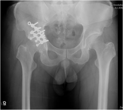 2017/12/23 花蓮慈院《真實之路，感恩有您》溫馨座談日誌(七之二) ─ ─ 異鄉車禍徬徨無助　「鄺」世妙手細心拚骨（文/黃思齊）