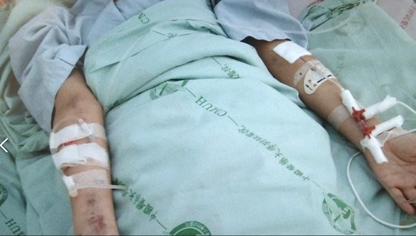 2018/11/03慈濟骨髓幹細胞中心日誌:廿五周年慶相見歡~陳雅君,沈日皓