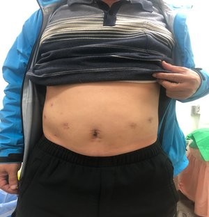 2019/05/15 花蓮慈院《守護生命 從早到晚 從小到老》溫馨座談日誌(三之二)─ ─花開見果擔使命 拔苦予樂步生蓮