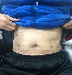 2019/05/15 花蓮慈院《守護生命 從早到晚 從小到老》溫馨座談日誌(三之二)─ ─花開見果擔使命 拔苦予樂步生蓮