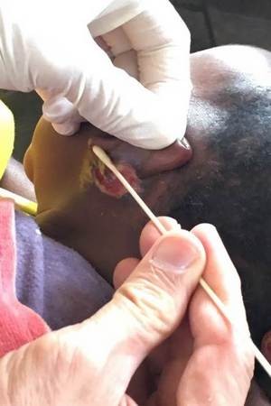 2019/05/29《長情醫愛.莫忘那一念》花蓮慈濟醫院日誌(一)--用愛守護翻轉東非 莫三比克賑災義診愛分享