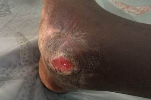 2019/05/29《長情醫愛.莫忘那一念》花蓮慈濟醫院日誌(一)--用愛守護翻轉東非 莫三比克賑災義診愛分享