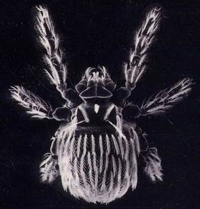 恙蟲病誤認性病 醫療專業還清白