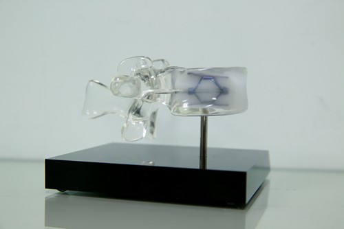 醫療級「千斤頂」　脊椎壓迫性骨折新選擇