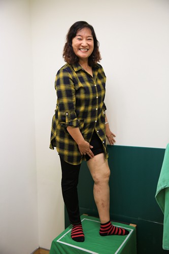 醫療與美感　超級微創雷射靜脈曲張切除手術