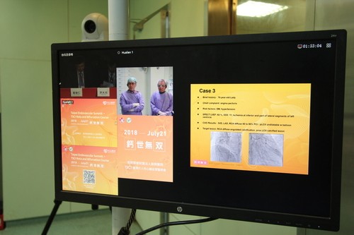 Live Demo冠狀動脈介入性治療　國際心臟血管專家齊聚交流