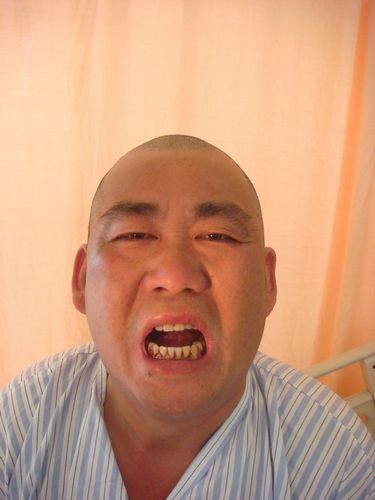 跨團隊醫療精準手術　從頭到腳再造自信人生