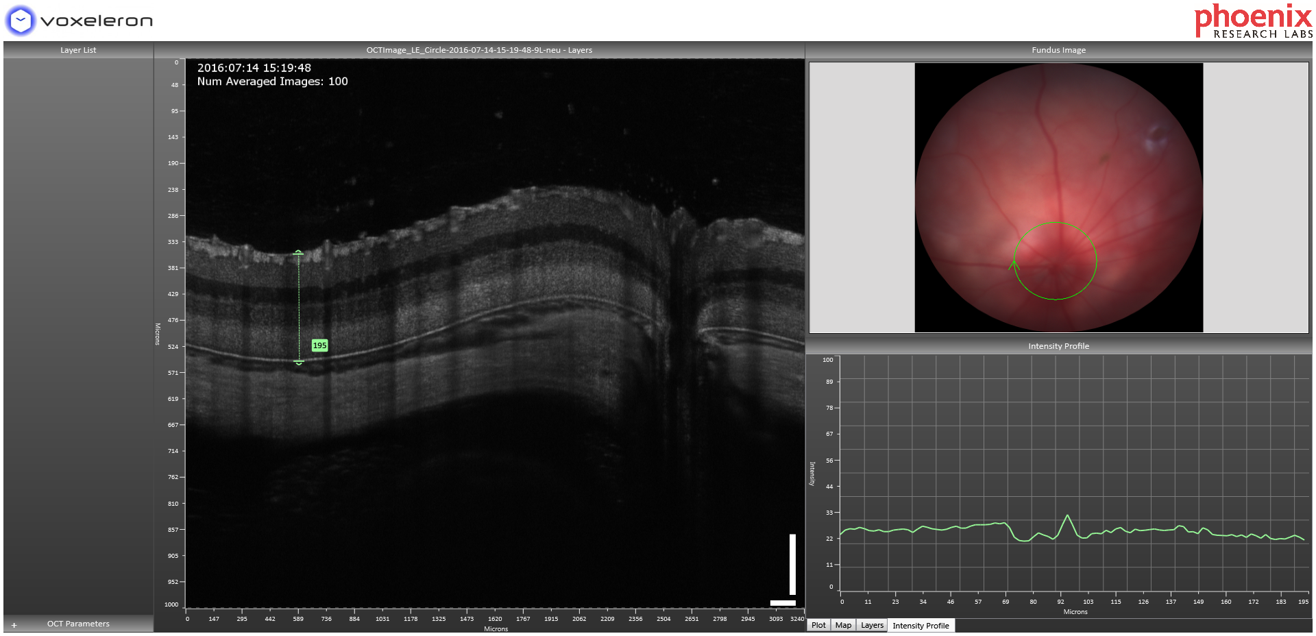 Quantification of OCT image