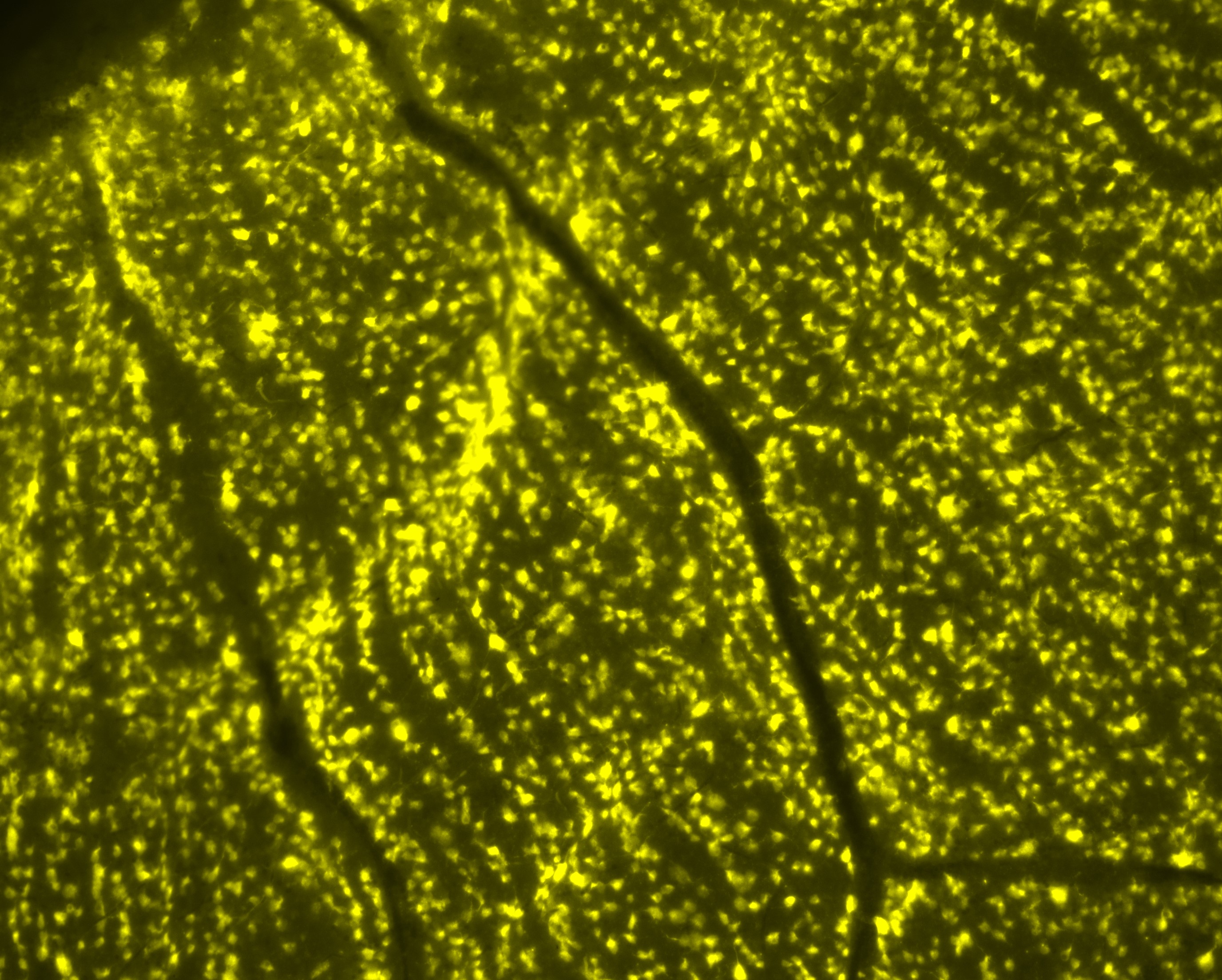 Quantification of OCT image