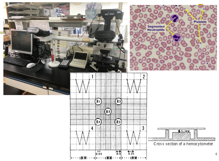 血液腫瘤科吳懿峰醫師介紹出血性疾病之檢驗診斷