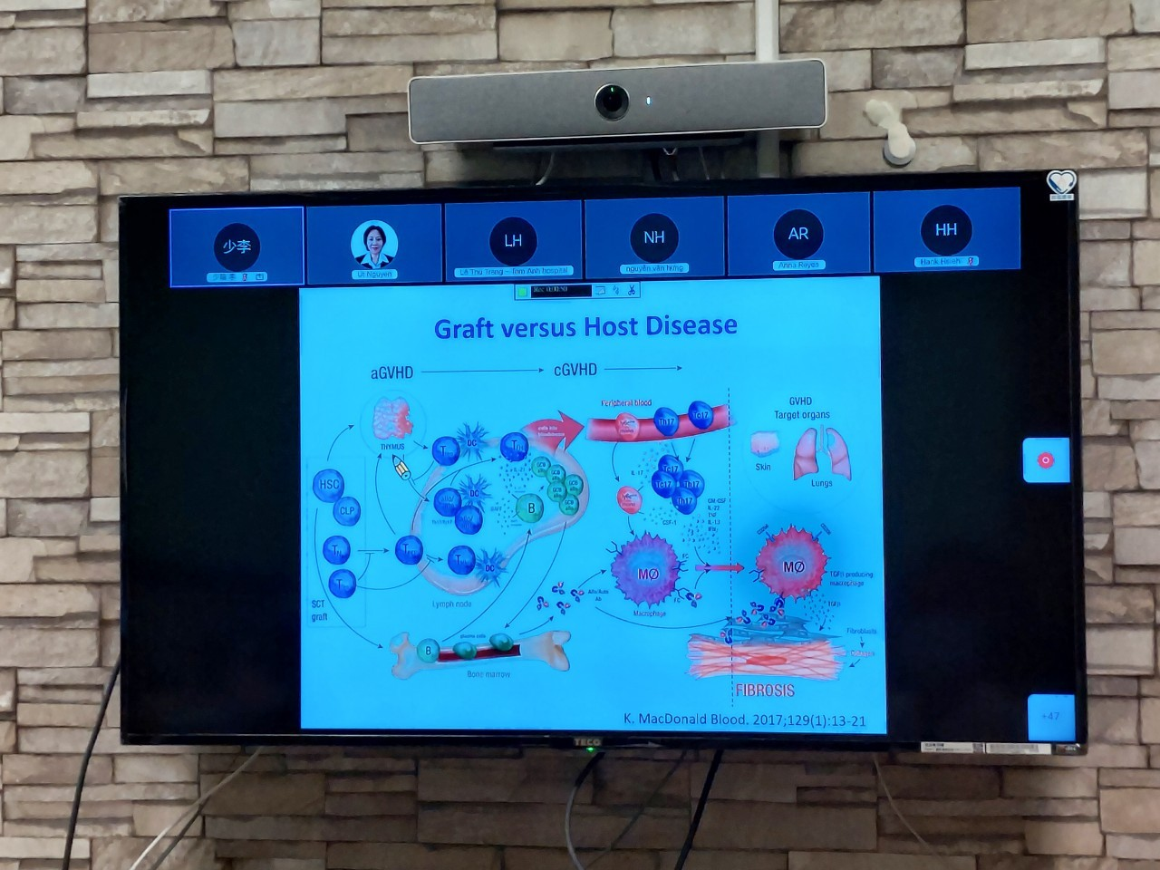 2021/08/18(三)新南向造血幹細胞移植遠距進階跨國講座: Acute GVHD After Allo-HSCT台大醫院血液腫瘤科蔡承宏醫師。