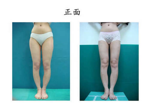 回診病患照片正面