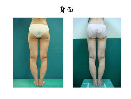 回診病患照片背面